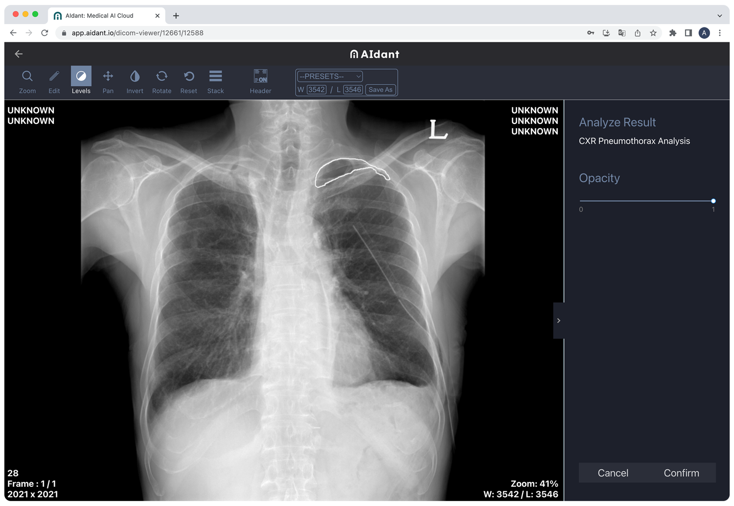 Promedius Inc. brings cutting-edge medical imaging AI cloud platform, AIdant to GITEX AFRICA 2023