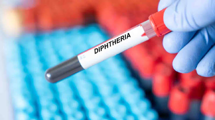 MOH Partners MDAs to curb ongoing Diphtheria outbreak